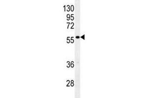 Glypican 3 antibody western blot analysis in mouse stomach tissue lysate (Glypican 3 抗体  (AA 21-50))