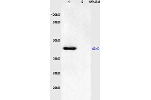 L1 mouse brain lysates L2 human colon carcinoma lysates probed with Anti - phospho-JNK1/2/3 (Thr183+Tyr185) Polyclonal Antibody, Unconjugated (ABIN732368) at 1:200 in 4 °C. (JNK 抗体  (pThr183, pTyr185))