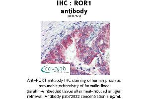 Image no. 1 for anti-Receptor Tyrosine Kinase-Like Orphan Receptor 1 (ROR1) (C-Term) antibody (ABIN1738934) (ROR1 抗体  (C-Term))