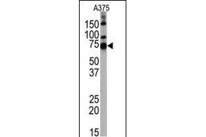 Western blot analysis of anti-HDAC10 Pab (Cat. (HDAC10 抗体  (N-Term))