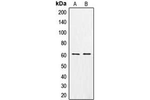 Western blot analysis of CSGALNACT1 expression in MCF7 (A), K562 (B) whole cell lysates. (CSGALNACT1 抗体  (Center))