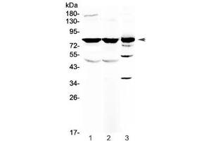 Western blot testing of 1) rat brain, 2) mouse brain and 3) human HepG2 antibody at 0. (NSF 抗体)