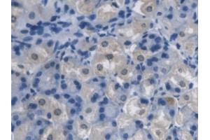 Detection of PCYOX1 in Mouse Stomach Tissue using Polyclonal Antibody to Prenylcysteine Oxidase 1 (PCYOX1) (PCYOX1 抗体  (AA 249-505))