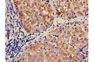 Immunohistochemistry of paraffin-embedded human liver tissue using ABIN7145998 at dilution of 1:100 (CCL3 抗体  (AA 25-81))