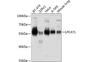 Western blot analysis of extracts of various cell lines, using LPC antibody (ABIN6130983, ABIN6143295, ABIN6143296 and ABIN6220819) at 1:1000 dilution. (LPCAT1 抗体  (AA 325-534))