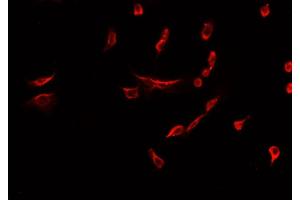 ABIN6277934 staining HepG2? (Nestin 抗体  (C-Term))
