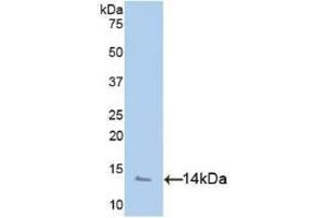 Detection of Recombinant PF4, Human using Polyclonal Antibody to Platelet Factor 4 (PF4) (PF4 抗体  (AA 31-101))