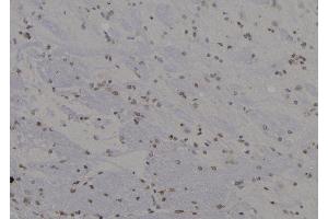 Immunohistochemistry (IHC) image for anti-S-Phase Kinase-Associated Protein 1 (SKP1) (Internal Region) antibody (ABIN6265102)
