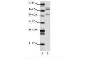 Image no. 1 for anti-GATA Zinc Finger Domain Containing 2B (GATAD2B) (AA 61-110) antibody (ABIN6736149) (GATAD2B 抗体  (AA 61-110))