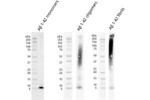 Western blot of amyloid beta 1-42 monomers (ABIN7272125, ABIN7272126 and ABIN7272127, left), oligomers (ABIN7272125, ABIN7272126 and ABIN7272127, middle) and fibrils (ABIN7272125, ABIN7272126 and ABIN7272127, right) using anti-amyloid beta 6E10 antibody. (beta Amyloid 蛋白)