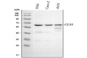 Western blot analysis of CGAS using anti-CGAS antibody (ABIN7600586).