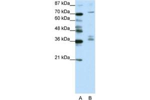 Western Blotting (WB) image for anti-A Kinase (PRKA) Anchor Protein (Yotiao) 9 (AKAP9) antibody (ABIN2461765) (AKAP9 抗体)