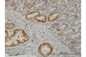 Immunoperoxidase of monoclonal antibody to TLN1 on formalin-fixed paraffin-embedded human small Intestine. (TLN1 抗体  (AA 1052-1149))