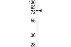Western blot analysis of TLK2 antibody and mouse testis tissue lysate. (TLK2 抗体  (AA 141-171))