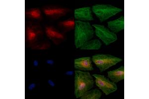 Phospho-Beclin 1 (Ser295) Antibody staining A549 cells(heat shock treatment) by IF/ICC.
