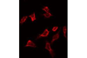 ABIN6266904 staining HeLa by IF/ICC. (PFKFB1/4 抗体)