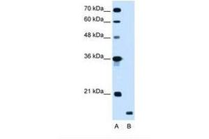 Image no. 1 for anti-Ring Finger Protein 175 (RNF175) (AA 58-107) antibody (ABIN341280) (RNF175 抗体  (AA 58-107))