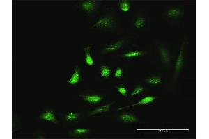 Immunofluorescence of purified MaxPab antibody to SIK1 on HeLa cell. (SIK1 抗体  (AA 1-783))