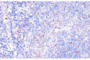 Immunohistochemistry of paraffin-embedded Rat spleen using CD18 Polyclonal Antibody at dilution of 1:100 (40x lens).