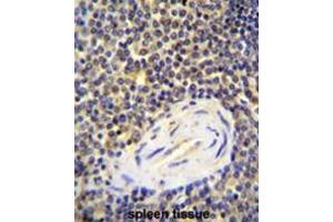 Immunohistochemistry (Paraffin-embedded Sections) (IHC (p)) image for anti-ArfGAP with Coiled-Coil, Ankyrin Repeat and PH Domains 1 (ACAP1) (AA 103-132), (N-Term) antibody (ABIN950226)