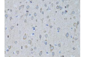 Immunohistochemistry of paraffin-embedded rat brain using GABARAP antibody (ABIN5973270) at dilution of 1/100 (40x lens). (GABARAP 抗体)