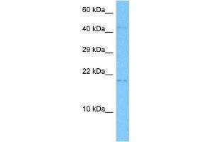 Host:  Mouse  Target Name:  GADD45B  Sample Tissue:  Mouse Small Intestine  Antibody Dilution:  1ug/ml (GADD45B 抗体  (Middle Region))