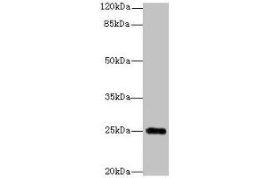 Western blot All lanes: GOSR2 antibody at 4 μg/mL + Jurkat whole cell lysate Secondary Goat polyclonal to rabbit IgG at 1/10000 dilution Predicted band size: 25, 23 kDa Observed band size: 25 kDa (GOSR2 抗体  (AA 1-190))