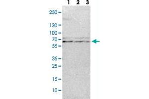 Western Blot (Cell lysate) analysis with TRAF3 polyclonal antibody  Lane 1: NIH-3T3 cell lysate (Mouse embryonic fibroblast cells) Lane 2: NBT-II cell lysate (Rat Wistar bladder tumour cells) Lane 3: PC12 cell lysate (Pheochromocytoma of rat adrenal medulla)