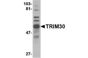 Image no. 1 for anti-Tripartite Motif Containing 30 (Trim30) (C-Term) antibody (ABIN342695) (TRIM30 抗体  (C-Term))