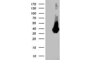 HEK293T cells were transfected with the pCMV6-ENTRY control (Left lane) or pCMV6-ENTRY LDLRAP1 (Right lane) cDNA for 48 hrs and lysed. (LDLRAP1 抗体)