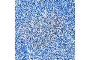 Immunohistochemistry of paraffin-embedded rat spleen using PAICS antibody. (PAICS 抗体  (AA 176-425))