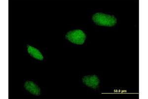Immunofluorescence of purified MaxPab antibody to ZBTB32 on HeLa cell. (ZBTB32 抗体  (AA 1-302))