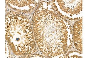 ABIN6262174 and ABIN6269018 at 1/100 staining Rat testis tissue by IHC-P. (HDAC10 抗体  (N-Term))