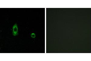 Peptide - +Western blot analysis of extracts from A549 cells, using CXG2 antibody.