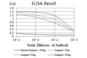 Black line: Control Antigen (100 ng), Purple line: Antigen(10 ng), Blue line: Antigen (50 ng), Red line: Antigen (100 ng), (MCM2 抗体)