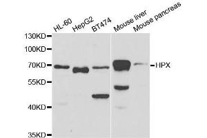 Western blot analysis of extracts of various cell lines, using HPX antibody. (Hemopexin 抗体  (AA 24-245))