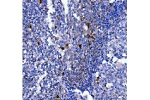 IHC analysis of NCR1 using anti-NCR1 antibody (ABIN7602013). (NCR1 抗体  (AA 55-258))