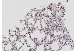 ABIN6276447 at 1/100 staining Mouse lung tissue by IHC-P. (Id2 抗体  (C-Term))