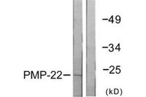 Western blot analysis of extracts from MDA-MB-435 cells, using PMP22 Antibody. (PMP22 抗体  (AA 111-160))