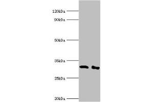 Western blot All lanes: Lymphocyte function-associated antigen 3 antibody at 2 μg/mL Lane 1: Hela whole cell lysate Lane 2: Jurkat whole cell lysate Secondary Goat polyclonal to rabbit IgG at 1/10000 dilution Predicted band size: 29, 27, 28 kDa Observed band size: 29 kDa (CD58 抗体  (AA 40-220))