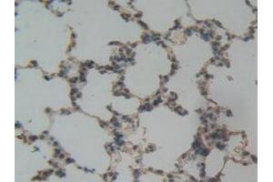 Immunohistochemistry (IHC) image for anti-Plasminogen Activator Inhibitor 1 (SERPINE1) (AA 24-402) antibody (ABIN7431938)
