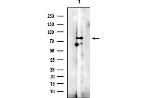 Western blot analysis of lysates from EC304 cells(heat-shock treatment), using Zyxin Mouse Monoclonal Antibody at 1/1000 dilution.