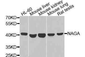 Western blot analysis of extracts of various cells, using NAGA antibody. (NAGA 抗体)