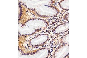 Immunohistochemistry (Paraffin-embedded Sections) (IHC (p)) image for anti-RAC1 antibody (ABIN6242819)