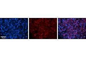 Immunohistochemistry (IHC) image for anti-Zinc Finger RNA Binding Protein (ZFR) (Middle Region) antibody (ABIN2775852)