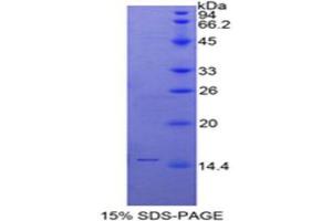 SDS-PAGE analysis of Human SLURP1 Protein. (SLURP1 蛋白)