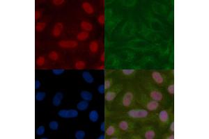 Apc11 Mouse Monoclonal Antibody staining Hela cells by IF/ICC. (ANAPC11 抗体)