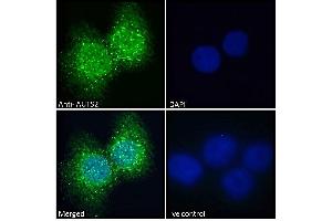 ABIN308459 Immunofluorescence analysis of paraformaldehyde fixed A431 cells, permeabilized with 0. (AUTS2 抗体  (C-Term))