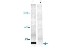 Western blot of rat brainstem lysate showing specific immuno- labeling of the ~29k 14-3-3 protein phosphorylated at Ser58 (Control, lane 1). (14-3-3 Pan (pSer58) 抗体)