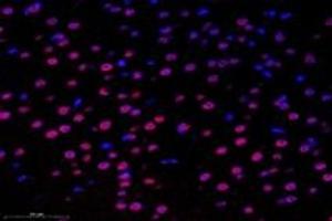 Immunofluorescent analysis of paraformaldehyde-fixed mouse substantia nigra using,SUN2 (ABIN7075502) at dilution of 1: 1000 (SUN2 抗体)